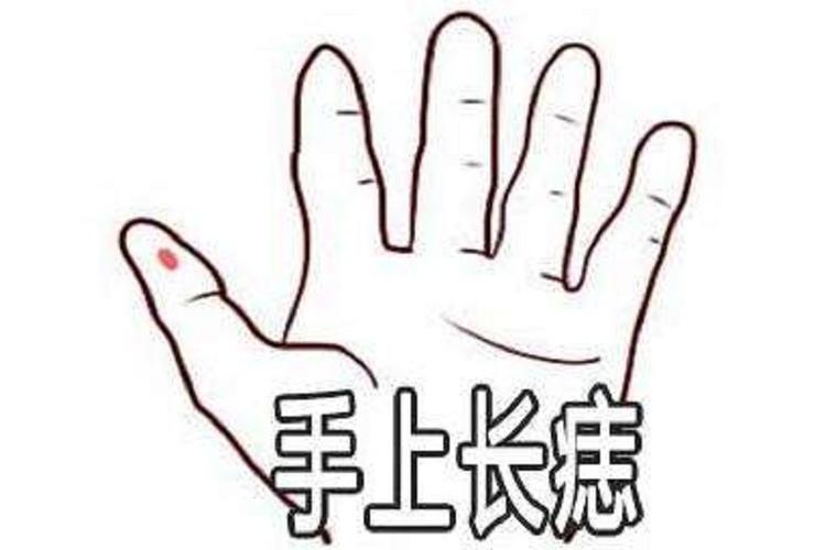 女生右手食指有痣代表什么意思